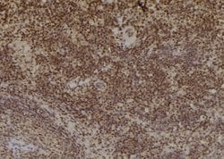 Invitrogen Tyrosinase Polyclonal Antibody 100 &mu;L; Unconjugated:Antibodies,
