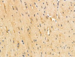 TNFAIP6 Polyclonal Antibody:Antibodies, Polyclonal