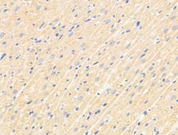 TNFAIP6 Polyclonal Antibody:Antibodies, Polyclonal
