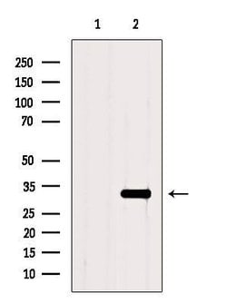 TNFAIP6 Polyclonal Antibody:Antibodies, Polyclonal