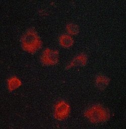 Invitrogen IkB epsilon Polyclonal Antibody 100 &mu;L; Unconjugated:Antibodies,