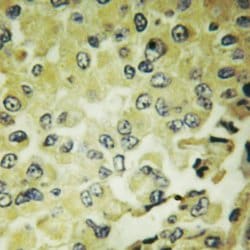 Invitrogen IkB epsilon Polyclonal Antibody 100 &mu;L; Unconjugated:Antibodies,