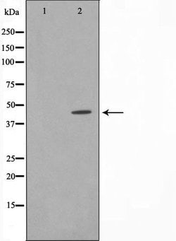 Invitrogen IkB epsilon Polyclonal Antibody 100 &mu;L; Unconjugated:Antibodies,