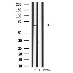 Invitrogen PDPK1 Polyclonal Antibody 100 &mu;L; Unconjugated:Antibodies,