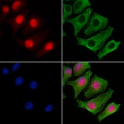 Invitrogen PDPK1 Polyclonal Antibody 100 &mu;L; Unconjugated:Antibodies,