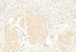 Invitrogen MiTF Polyclonal Antibody 100 &mu;L; Unconjugated:Antibodies,