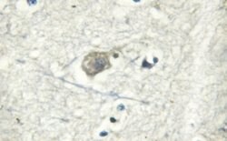 Invitrogen ATP1A1 Polyclonal Antibody 100 &mu;L; Unconjugated:Antibodies,