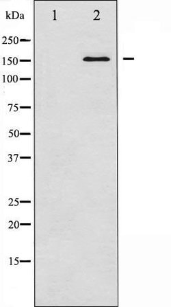 Invitrogen Bcr Polyclonal Antibody 100 &mu;L; Unconjugated:Antibodies,