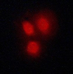 Invitrogen VDR Polyclonal Antibody 100 &mu;L; Unconjugated:Antibodies,