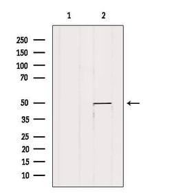 Invitrogen VDR Polyclonal Antibody 100 &mu;L; Unconjugated:Antibodies,