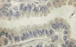 Invitrogen VAV1 Polyclonal Antibody 100 &mu;L; Unconjugated:Antibodies,