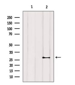 Invitrogen Cardiac Troponin I Polyclonal Antibody 100 &mu;L; Unconjugated:Antibodies,