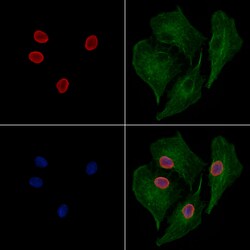 Invitrogen JNK1/JNK2/JNK3 Polyclonal Antibody 100 &mu;L; Unconjugated:Antibodies,