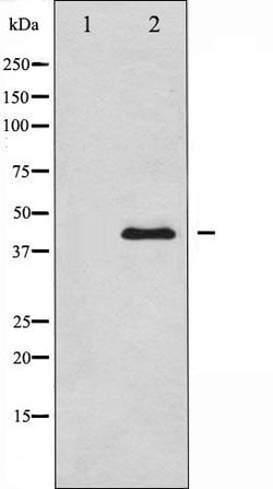 JNK1/JNK2/JNK3 Polyclonal Antibody, Invitrogen 100 &mu;L; Unconjugated:Antibodies,