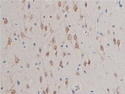 Invitrogen GSK3 alpha/beta Polyclonal Antibody 100 &mu;L; Unconjugated:Antibodies,
