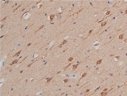 Invitrogen GSK3 alpha/beta Polyclonal Antibody 100 &mu;L; Unconjugated:Antibodies,