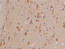 Invitrogen GSK3 alpha/beta Polyclonal Antibody 100 &mu;L; Unconjugated:Antibodies,