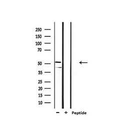 Invitrogen GSK3 alpha/beta Polyclonal Antibody 100 &mu;L; Unconjugated:Antibodies,