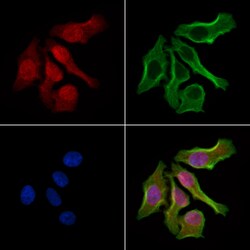 Invitrogen LIMK1/LIMK2 Polyclonal Antibody 100 &mu;L; Unconjugated:Antibodies,