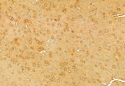 Invitrogen RHOA Polyclonal Antibody 100 &mu;L; Unconjugated:Antibodies,