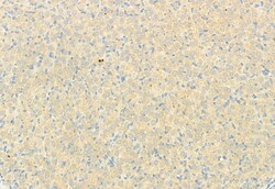 Invitrogen RHOA Polyclonal Antibody 100 &mu;L; Unconjugated:Antibodies,