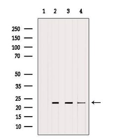 Invitrogen RHOA Polyclonal Antibody 100 &mu;L; Unconjugated:Antibodies,