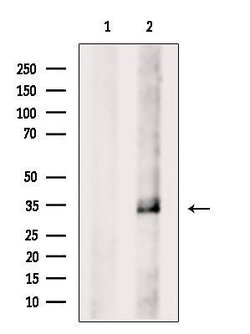 Invitrogen CDK5 Polyclonal Antibody 100 &mu;L | Buy Online | Invitrogen&trade; | Fisher Scientific