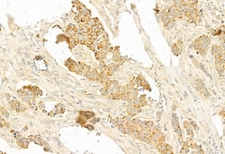 Invitrogen MEK1/MEK2 Polyclonal Antibody 100 &mu;L; Unconjugated:Antibodies,