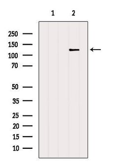 Invitrogen NFATC3 Polyclonal Antibody 100 &mu;L | Buy Online | Invitrogen&trade; | Fisher Scientific