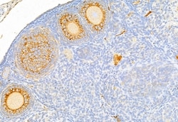 Invitrogen Acetyl-CoA Carboxylase Polyclonal Antibody 100 &mu;L; Unconjugated:Antibodies,