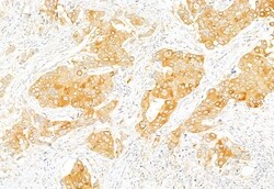 Invitrogen Acetyl-CoA Carboxylase Polyclonal Antibody 100 &mu;L; Unconjugated:Antibodies,
