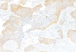 Invitrogen Acetyl-CoA Carboxylase Polyclonal Antibody 100 &mu;L; Unconjugated:Antibodies,