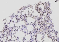 Invitrogen Acetyl-CoA Carboxylase Polyclonal Antibody 100 &mu;L; Unconjugated:Antibodies,