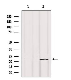Invitrogen BIK Polyclonal Antibody 100 &mu;L; Unconjugated:Antibodies,