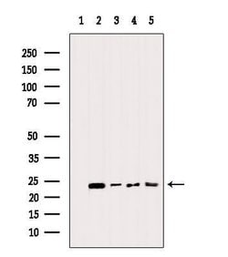 Invitrogen BIK Polyclonal Antibody 100 &mu;L; Unconjugated:Antibodies,