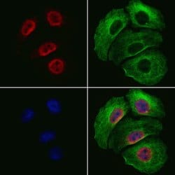 Invitrogen TRAP220 Polyclonal Antibody 100 &mu;L | Buy Online | Invitrogen&trade; | Fisher Scientific