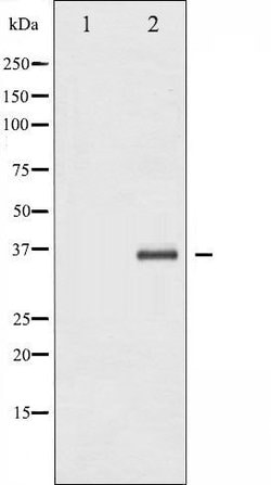 Invitrogen IkB beta Polyclonal Antibody 100 &mu;L; Unconjugated:Antibodies,