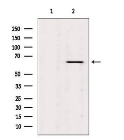 Invitrogen LKB1 Polyclonal Antibody 100 μL; Unconjugated:Antibodies,