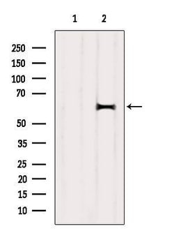 Invitrogen DOK1 Polyclonal Antibody 100 &mu;L; Unconjugated:Antibodies,
