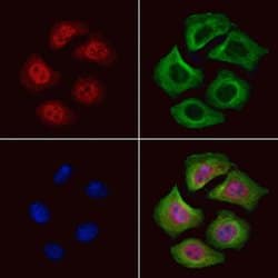 GRF-1 Polyclonal Antibody:Antibodies, Polyclonal
