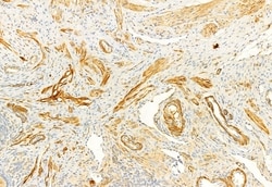 Invitrogen TIMP1 Polyclonal Antibody 100 &mu;L; Unconjugated:Antibodies,