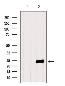 Invitrogen TIMP1 Polyclonal Antibody 100 &mu;L; Unconjugated:Antibodies,