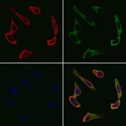 Invitrogen VEGFB Polyclonal Antibody 100 &mu;L | Buy Online | Invitrogen&trade; | Fisher Scientific