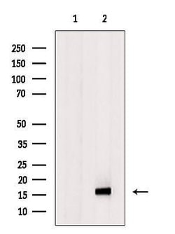 Invitrogen VEGFB Polyclonal Antibody 100 &mu;L | Buy Online | Invitrogen&trade; | Fisher Scientific