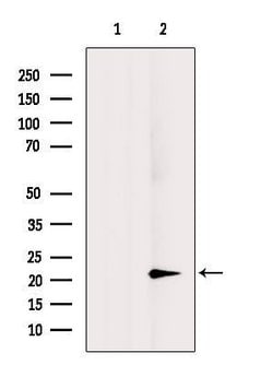 Invitrogen VEGFB Polyclonal Antibody 100 &mu;L | Buy Online | Invitrogen&trade; | Fisher Scientific