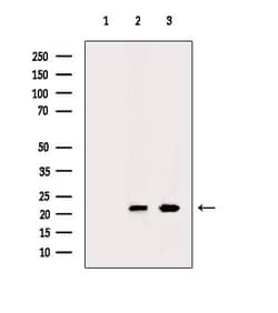 Invitrogen VEGFB Polyclonal Antibody 100 &mu;L | Buy Online | Invitrogen&trade; | Fisher Scientific