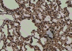 Invitrogen Phospho-TrkC (Tyr705) Polyclonal Antibody 100 &mu;L; Unconjugated:Antibodies,