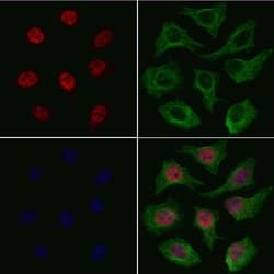 Invitrogen SF3B1 Polyclonal Antibody 100 &mu;L; Unconjugated:Antibodies,