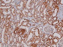 Phospho-p27 Kip1 (Thr157) Polyclonal Antibody:Antibodies, Polyclonal