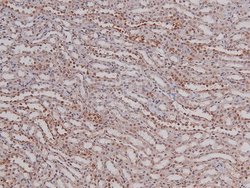 Phospho-p27 Kip1 (Thr157) Polyclonal Antibody:Antibodies, Polyclonal